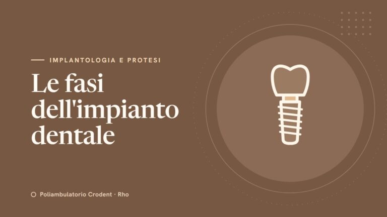 Impianti dentali: come funzionano e quali sono le fasi del trattamento